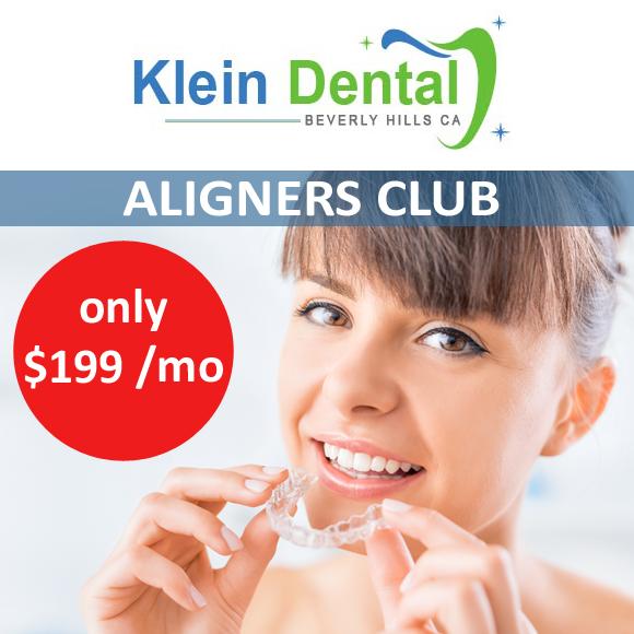 Aligners Club